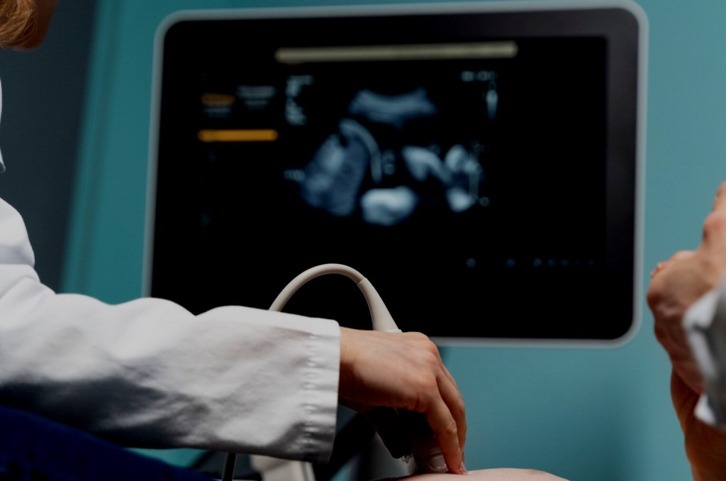 10 вопросов про УЗИ: отвечает врач